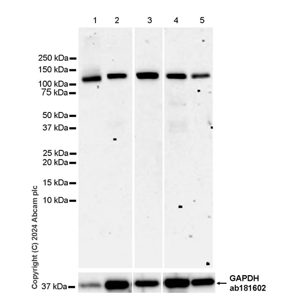 Western blot - Anti-XRN2 antibody [EPR28598-13] - BSA and Azide free (AB318133)