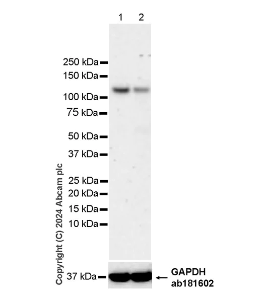 Western blot - Anti-XRN2 antibody [EPR28598-13] - BSA and Azide free (AB318133)