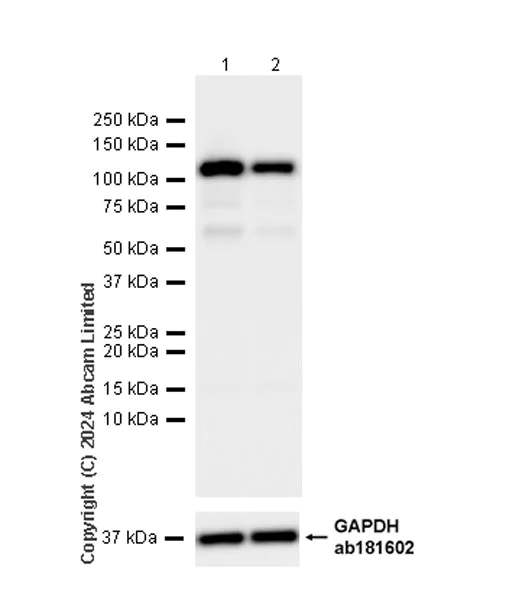 Western blot - Anti-XRN2 antibody [EPR28598-13] - BSA and Azide free (AB318133)