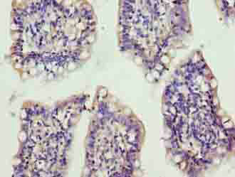 Immunohistochemistry (Formalin/PFA-fixed paraffin-embedded sections) - Anti-XRRA1 antibody (AB235784)