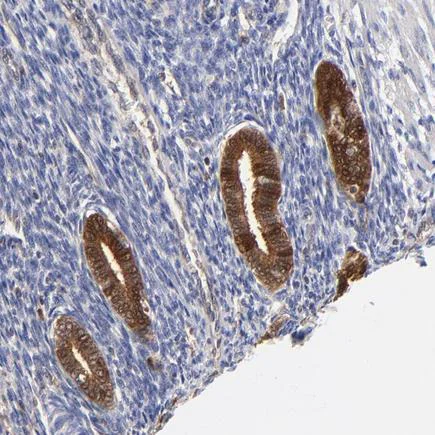 Immunohistochemistry (Formalin/PFA-fixed paraffin-embedded sections) - Anti-XTP3TPA antibody (AB224051)