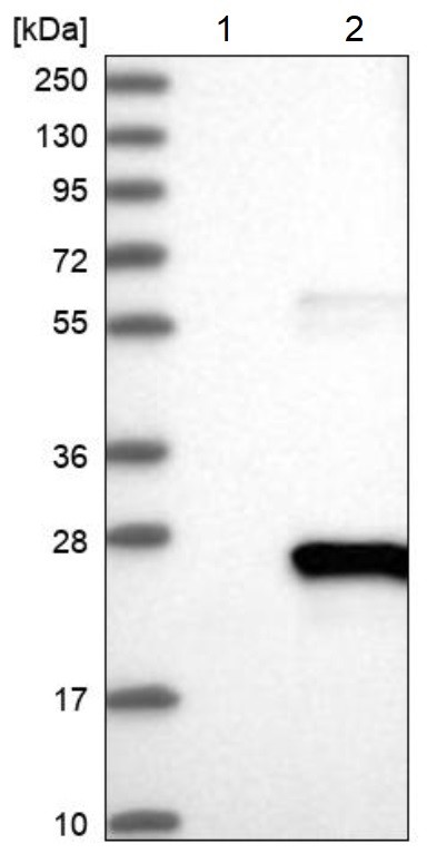 Western blot - Anti-XTP3TPA antibody (AB224051), expandable thumbnail
