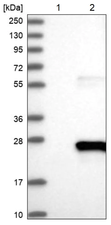 Western blot - Anti-XTP3TPA antibody (AB224051)