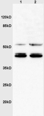Western blot - Anti-Xxylt1 antibody (AB203634)