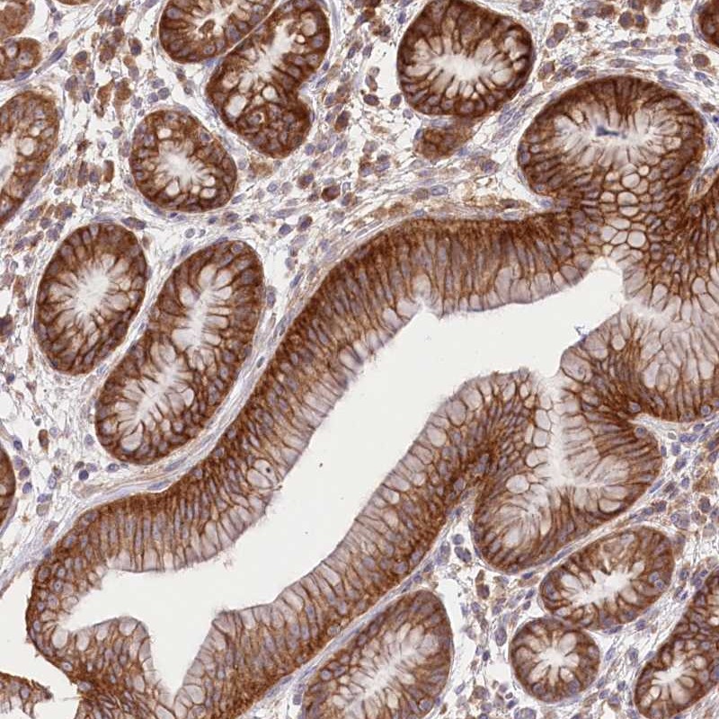 Immunohistochemistry (Formalin/PFA-fixed paraffin-embedded sections) - Anti-XYLB antibody (AB254831), expandable thumbnail
