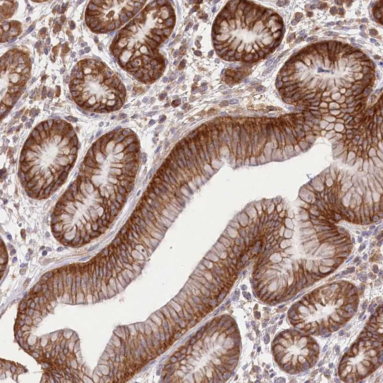 Immunohistochemistry (Formalin/PFA-fixed paraffin-embedded sections) - Anti-XYLB antibody (AB254831)