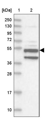 Western blot - Anti-XYLB antibody (AB254831), expandable thumbnail
