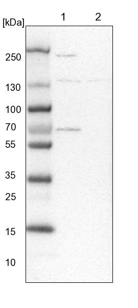 Western blot - Anti-XYLB antibody (AB254831), expandable thumbnail