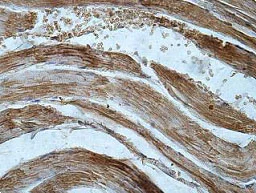 Immunohistochemistry (Formalin/PFA-fixed paraffin-embedded sections) - Anti-XYLT1 antibody (AB197193)