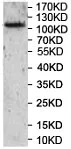 Western blot - Anti-XYLT1 antibody (AB197193)