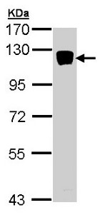 Western blot - Anti-XYLT2 antibody (AB155193), expandable thumbnail