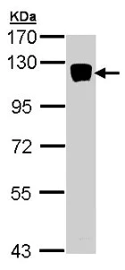Western blot - Anti-XYLT2 antibody (AB155193)