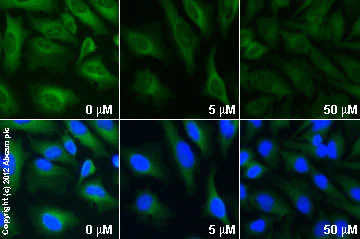 Functional Studies - Y-27632 dihydrochloride, Rho kinase inhibitor (AB120129)