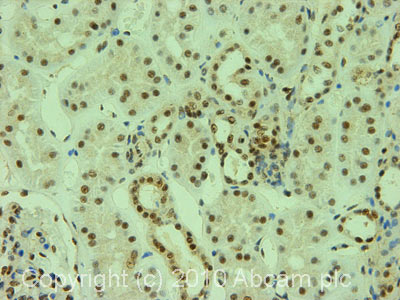 Immunohistochemistry (Formalin/PFA-fixed paraffin-embedded sections) - Anti-Y14 antibody [4C4] (AB5828)