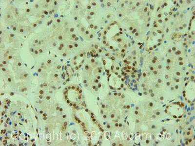 Immunohistochemistry (Formalin/PFA-fixed paraffin-embedded sections) - Anti-Y14 antibody [4C4] (AB5828)