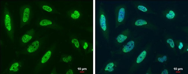 Immunocytochemistry/ Immunofluorescence - Anti-Y14 antibody (AB229573), expandable thumbnail