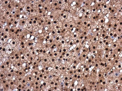 Immunohistochemistry (Formalin/PFA-fixed paraffin-embedded sections) - Anti-Y14 antibody (AB229573)