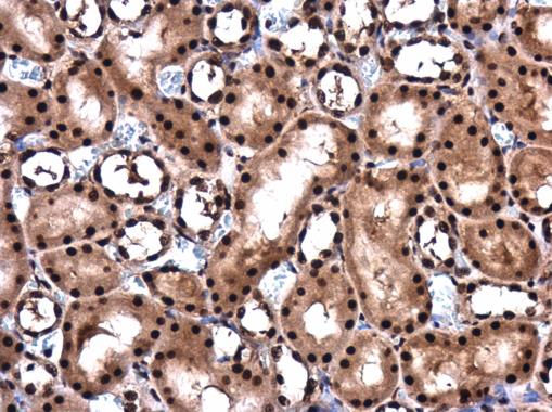 Immunohistochemistry (Formalin/PFA-fixed paraffin-embedded sections) - Anti-Y14 antibody (AB229573), expandable thumbnail