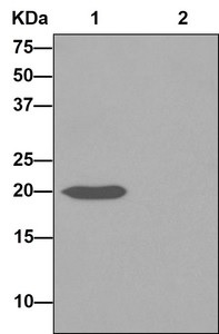 Anti-Y14 antibody [EPR13945(B)]