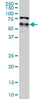Western blot - Anti-YAP1 antibody [2F12] (AB56701)