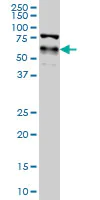 Western blot - Anti-YAP1 antibody [2F12] (AB56701)