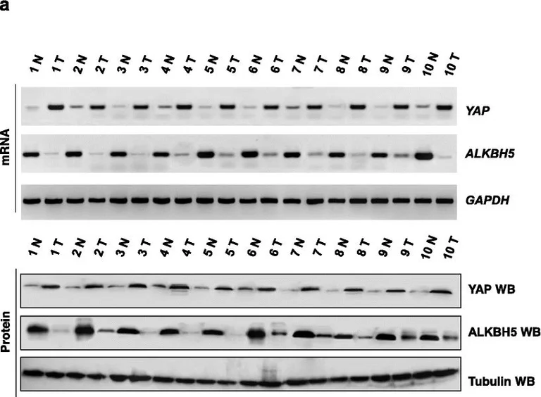 Western blot - Anti-YAP1 antibody [2F12] (AB56701)