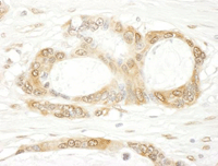 Immunohistochemistry (Formalin/PFA-fixed paraffin-embedded sections) - Anti-YAP1 antibody (AB114862)