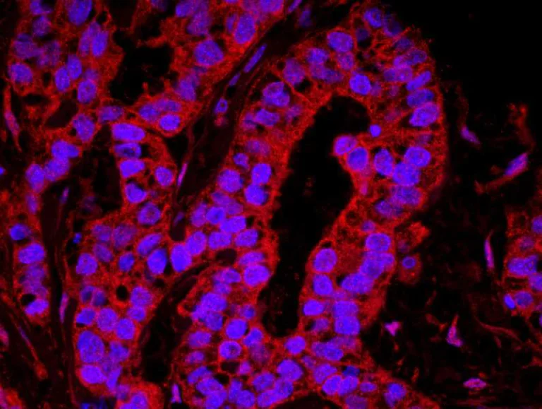 Immunohistochemistry (Formalin/PFA-fixed paraffin-embedded sections) - Anti-YAP1 antibody (AB114862)