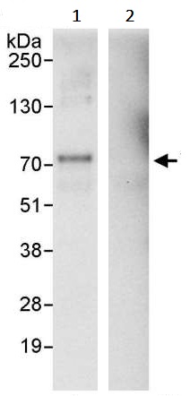 Immunoprecipitation - Anti-YAP1 antibody (AB245286), expandable thumbnail