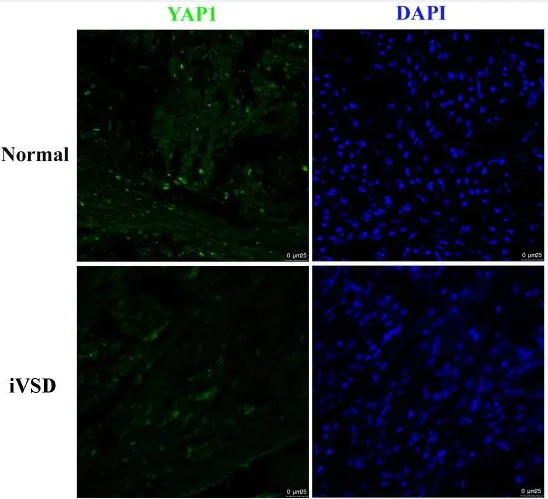 Immunocytochemistry/ Immunofluorescence - Anti-YAP1 antibody [EP1674Y] (AB52771)