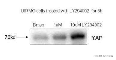 Western blot - Anti-YAP1 antibody [EP1674Y] (AB52771)