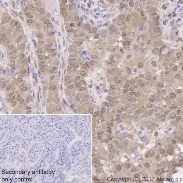 Immunohistochemistry (Formalin/PFA-fixed paraffin-embedded sections) - Anti-YAP1 antibody [EP1674Y] - BSA and Azide free (AB172373)
