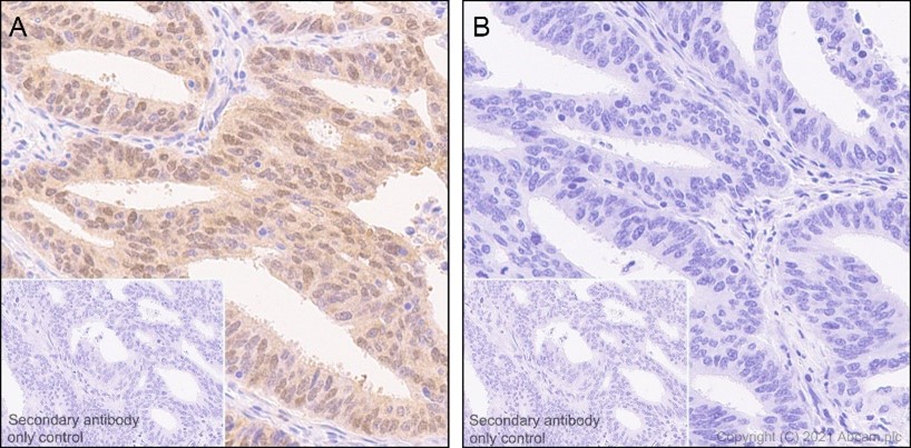 Anti-YAP1 (phospho S127) antibody [EP1675Y] (ab76252) | Abcam