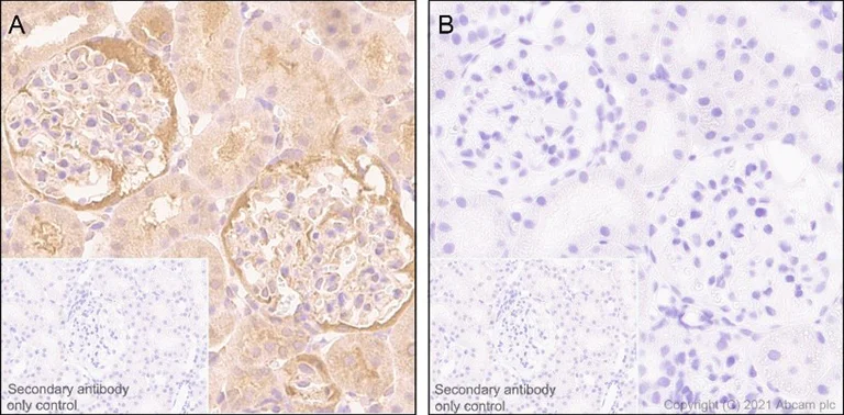 Immunohistochemistry (Formalin/PFA-fixed paraffin-embedded sections) - Anti-YAP1 (phospho S127) antibody [EP1675Y] (AB76252)