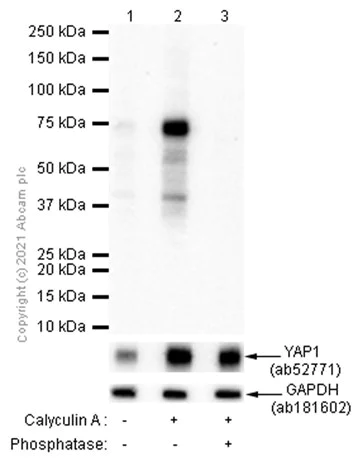 maaページ Anti-SIK3 (phospho S551) antibody [EPR20878-12] - BSA and
