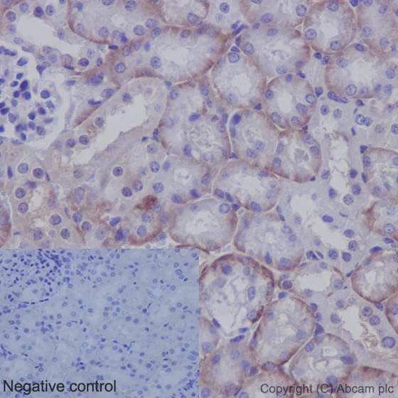 Immunohistochemistry (Formalin/PFA-fixed paraffin-embedded sections) - Anti-YAP1 (phospho S127) antibody [EP1675Y] - BSA and Azide free (AB172374)