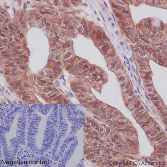 Immunohistochemistry (Formalin/PFA-fixed paraffin-embedded sections) - Anti-YAP1 (phospho S127) antibody [EP1675Y] - BSA and Azide free (AB172374)