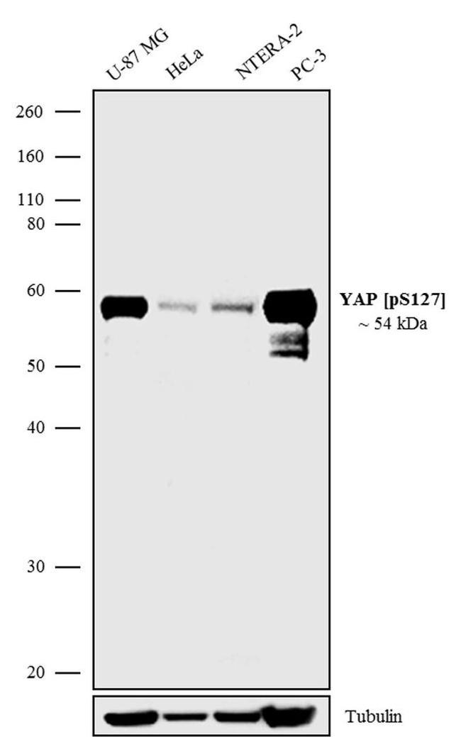 Western blot - Anti-YAP1 (phospho S127) Antibody [RP23040163] (AB313464), expandable thumbnail