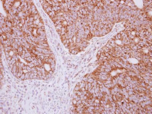 Immunohistochemistry (Formalin/PFA-fixed paraffin-embedded sections) - Anti-YARS2/TyRS antibody (AB228957)