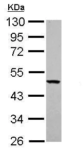 Western blot - Anti-YARS2/TyRS antibody (AB228957)