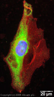 Immunocytochemistry/ Immunofluorescence - Anti-YB1 antibody (AB12148)