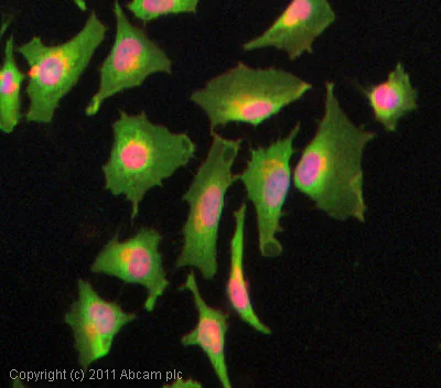 Immunocytochemistry/ Immunofluorescence - Anti-YB1 antibody (AB12148)