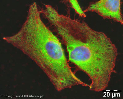 Immunocytochemistry/ Immunofluorescence - Anti-YB1 antibody (AB12148)