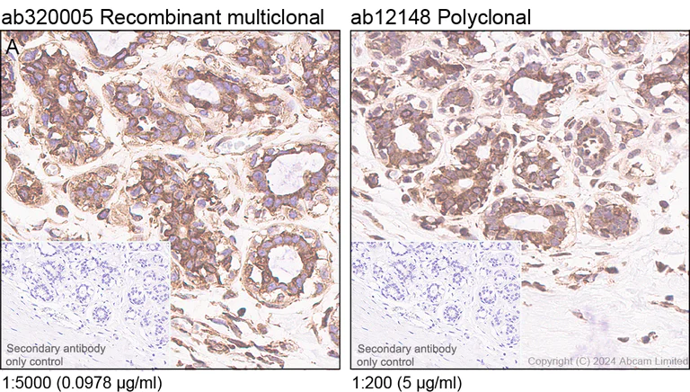 Immunohistochemistry (Formalin/PFA-fixed paraffin-embedded sections) - Anti-YB1 antibody (AB12148)