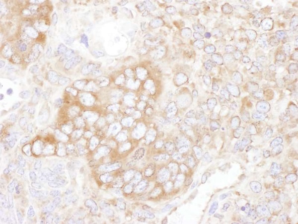 Immunohistochemistry (Formalin/PFA-fixed paraffin-embedded sections) - Anti-YB1 antibody (AB225706)
