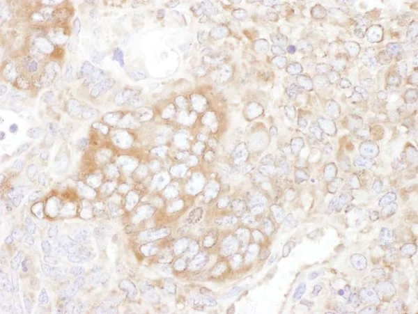 Immunohistochemistry (Formalin/PFA-fixed paraffin-embedded sections) - Anti-YB1 antibody (AB225706)