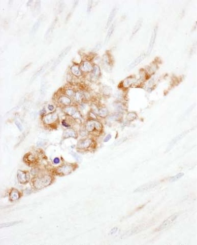 Immunohistochemistry (Formalin/PFA-fixed paraffin-embedded sections) - Anti-YB1 antibody (AB225706)