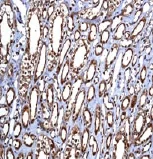 Immunohistochemistry (Formalin/PFA-fixed paraffin-embedded sections) - Anti-YB1 antibody [EP2708Y] (AB76149)