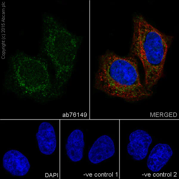 Immunocytochemistry/ Immunofluorescence - Anti-YB1 antibody [EP2708Y] - BSA and Azide free (AB239875)