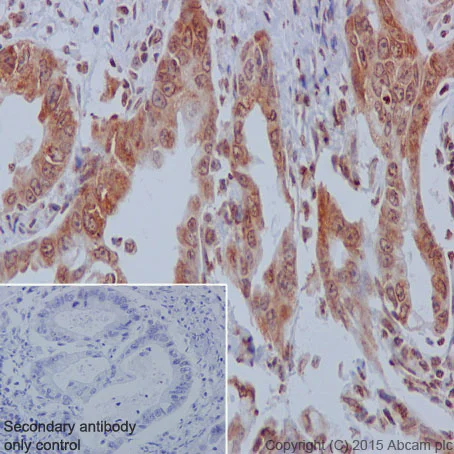 Immunohistochemistry (Formalin/PFA-fixed paraffin-embedded sections) - Anti-YB1 antibody [EP2708Y] - BSA and Azide free (AB239875)